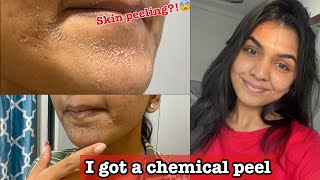 I got a chemical peel for acne scars Skin peeling  Experience [upl. by Nyrrad]