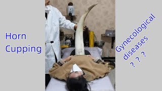 Gynecological diseases？？ [upl. by Friend273]