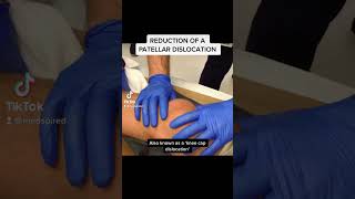 Reduction of a Patellar Dislocation [upl. by Arahsal238]