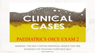 Pediatrics OSCE Exam 2 [upl. by Nytsrik]