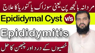 Epididymitis treatment in hindi  Epididymal cyst treatment  sozak Ka ilaj  Epididymitis [upl. by Nuahsyar]