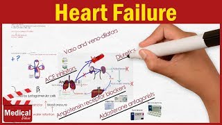 Pharmacology  Heart Failure Symptoms Causes and Treatment Options FROM A TO Z [upl. by Peppard864]