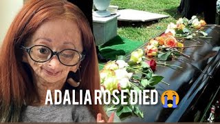 Adalia rose A YouTube star who battled Real life banjaminbutton disease dies yesterday [upl. by Annehcu]