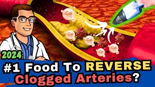 1 Food to Clean out Your Arteries Blood Clots amp Arteriosclerosis [upl. by Wei]