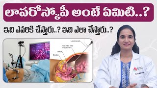 What is Laparoscopy  To Whom Laparoscopy can be done Explained By DrSumina Reddy  Fertilica IVF [upl. by Chernow]