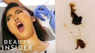 How Earwax Is Professionally Extracted  Beauty Explorers  Insider Beauty [upl. by Nalro142]