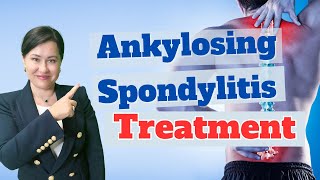 Ankylosing Spondylitis Treatment What They Dont Tell You [upl. by Allehs]