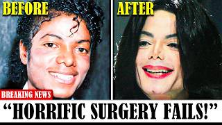 30 Times Plastic Surgery Went Horribly Wrong here goes my vote [upl. by Elocan]