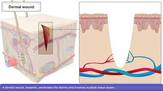 Skin Wound Healing Process [upl. by Nalniuq]