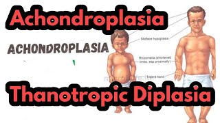 AchondroplasiaThanotropic DiplasiaDifference between Achondroplasia and Thanotropic DiplasiaRobin [upl. by Southard]