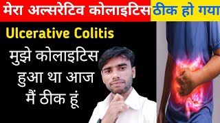 गंभीर बीमारी Ulcerative Colitis ठीक हो गये 💪😇 ulcerative colitis treatment in hindi [upl. by Kelby103]