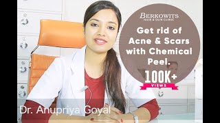 Chemical Peel for Acne Scar and Microneedling Skin Peeling Treatment [upl. by Gnud]