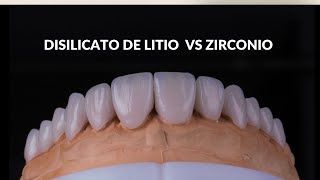 Disilicato de Litio vs Zirconio [upl. by Abebi173]