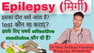 Epilepsy treatment in hindi  मिर्गी का इलाज हिंदी में [upl. by Madella]