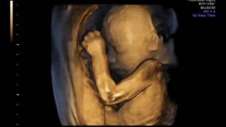 3D ultrasound 25 weeks 4D view of baby 25 week pregnancy baby girl first view [upl. by Aznaed]