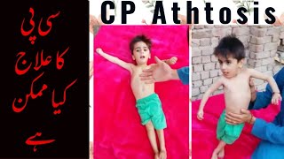 Dyskinetic amp Ataxic cerebral palsy  Movement types in CP  Spastic Quadriplegia Dr Khaqan [upl. by Prestige790]