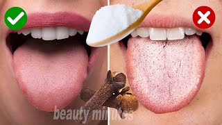 The best natural home remedy to eliminate annoying tongue ulcers as soon as possible [upl. by Yleoj]