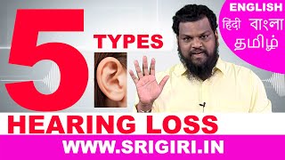 Hearing Loss Treatment  No Hearing Aid No Operation [upl. by Anyt]