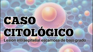 Lesión escamosa de bajo grado en citologia cervicovaginal [upl. by Nuoras]