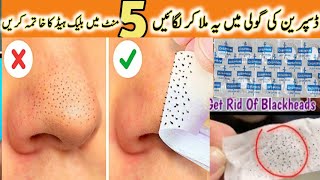 How To Remove BLACKHEADS Permanently From Nose amp Face Instantly 💯 Naturally At Home  No Whiteheads [upl. by Ellenoj]