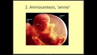 DAROGA Pregnancy Antenatal Screening Part 2 fetal aneuploidy Trisomy 21 and 18 [upl. by Palmer]