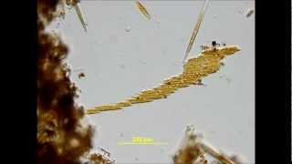 Bacillaria paxillifer  a diatom with a spectacular gliding movement [upl. by Ellehcirt]