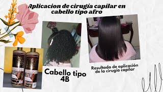 Aplicación de cirugía capilar paso a paso en cabello afro 4B [upl. by Rayner]