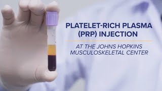 PlateletRich Plasma PRP Injections  QampA [upl. by Yahsram]