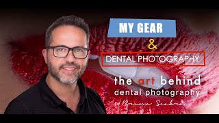 My Gear Intraoral Dental Photography [upl. by Aitnuahs479]