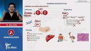 HEMATOLOGÍA  Anemias macrocíticas Anemias no megaloblásticas [upl. by Elleirol928]