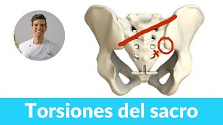 ✳️Mecánica y diagnóstico de las torsiones del sacro  osteopatía [upl. by Cralg560]