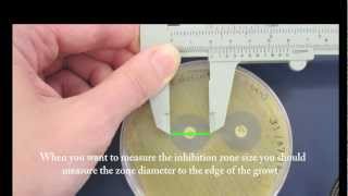 Microbiology resources  Callipers and Vernier Scale [upl. by Arekahs]