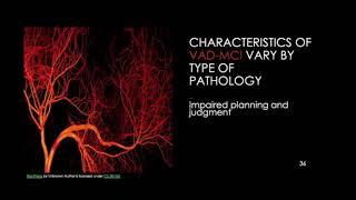 e265 Preview Mild Cognitive Impairment Assessment Challenges and Solutions [upl. by Holman509]