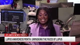 Lupus Awareness Month Unmasking the faces of Lupus [upl. by Aniakudo]