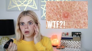 MAKEUP VS NO MAKEUP UNDER A MICROSCOPE 🤢 [upl. by Arakaj]