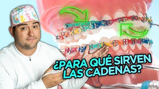 ¿PARA QUE SIRVEN LAS CADENAS ELÁSTICAS EN TUS BRACKETS ¿CUANDO SI Y CUANDO NO en tu ORTODONCIA [upl. by Enawd]