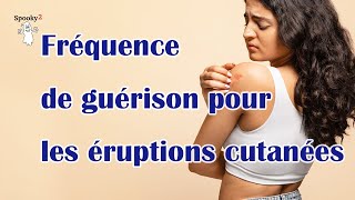 Fréquence de guérison pour les éruptions cutanées [upl. by Ajnat356]