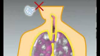 Dejar de fumar Efectos de la nicotina [upl. by Ilhsa]