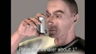 3D Medical Animation Inhaler [upl. by Erdei]