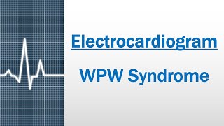 WPW syndrome Electrocardiogram [upl. by Odnomra927]