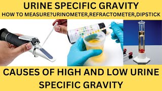 URINE SPECIFIC GRAVITYHOW TO MEASURECAUSES OF HIGH AND LOW SPECIFIC GRAVITYURINE ROUTINE [upl. by Seem]