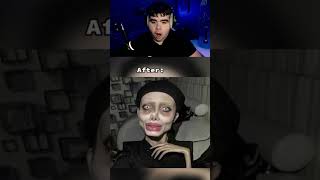 Worst Plastic Surgery Fails 😞 [upl. by Aneem51]