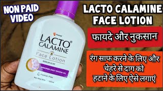 Lacto Calamine Face Lotion लैक्टो कैलामाइन लोशन  How to use lacto calamine lotion Review In Hindi [upl. by Notsnorb]