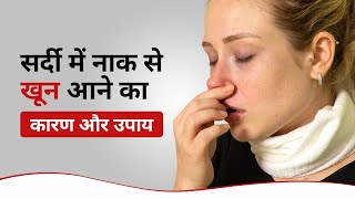 सर्दी जुकाम में नाक से खून आना  Nosebleed in Winter in Hindi  naak se khoon aane ka ilaj [upl. by Hezekiah110]