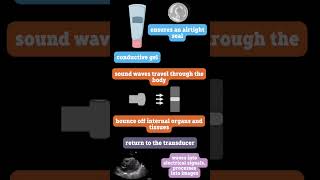 How Does Ultrasound Work [upl. by Killam685]