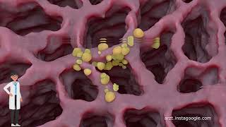 Unterschiede in den Symptomen zwischen Lungenkrebs und COPD [upl. by Chancelor]