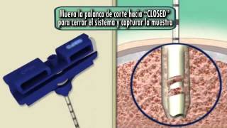 INSTRUCCIONES DE USO  Ranfac  Aguja para biopsia de medula osea y hueso con Bobina de captura [upl. by Ahsiral]