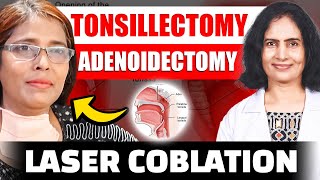 Laser Coblation Tonsillectomy and Adenoidectomy [upl. by Varin]