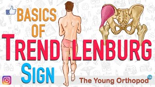 Trendelenburgs Sign  ANIMATION  BASICS  The Young Orthopod  Trendelenberg Sign [upl. by Ahsatak]