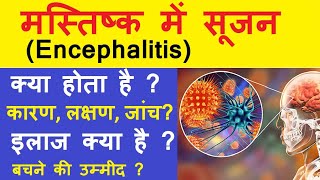 Encephalitis in hindi  Encephalitis क्या होता है  Encephalitis का इलाज  Encephalitis लक्षण कारण [upl. by Aryad447]